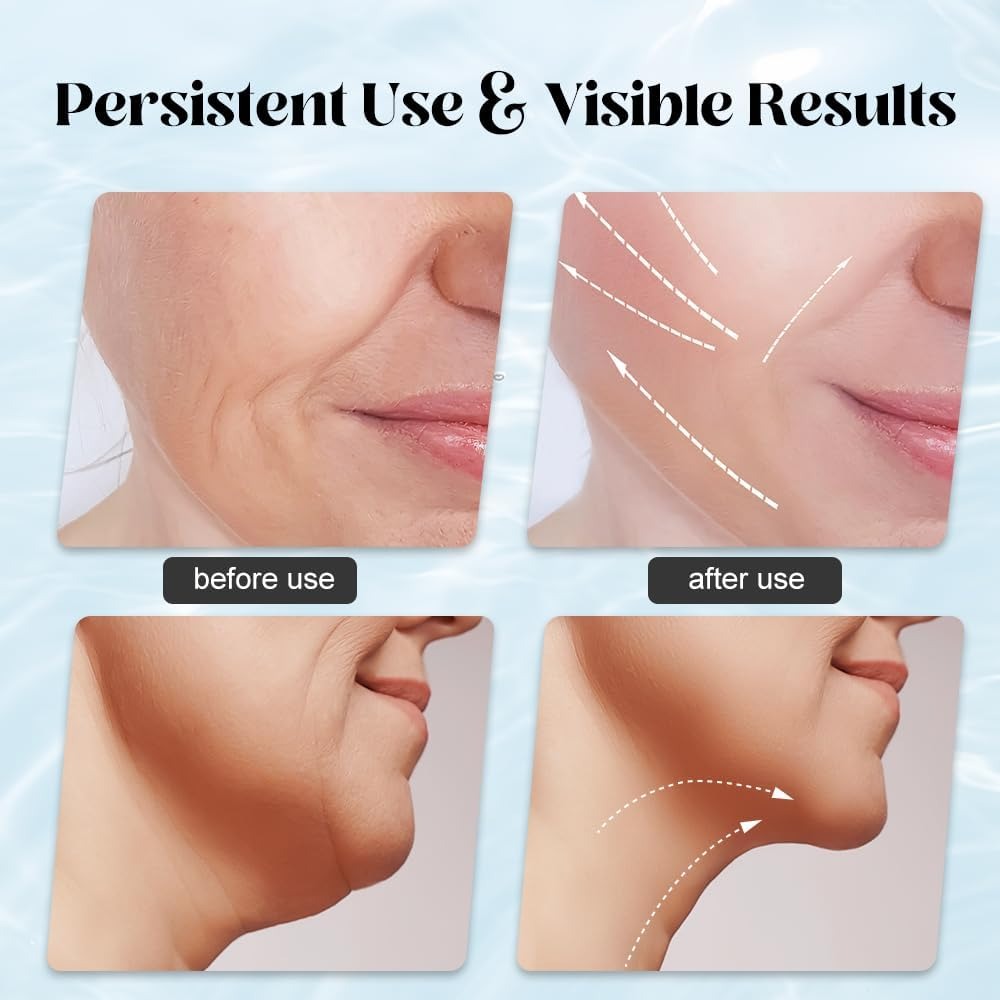 EMS Face Lifting Massager with Red Light Therapy | Facial, Neck & Eye Microcurrent Vibrating Massage Tool | Anti-Wrinkle Skin Tightening Device (Random Color)