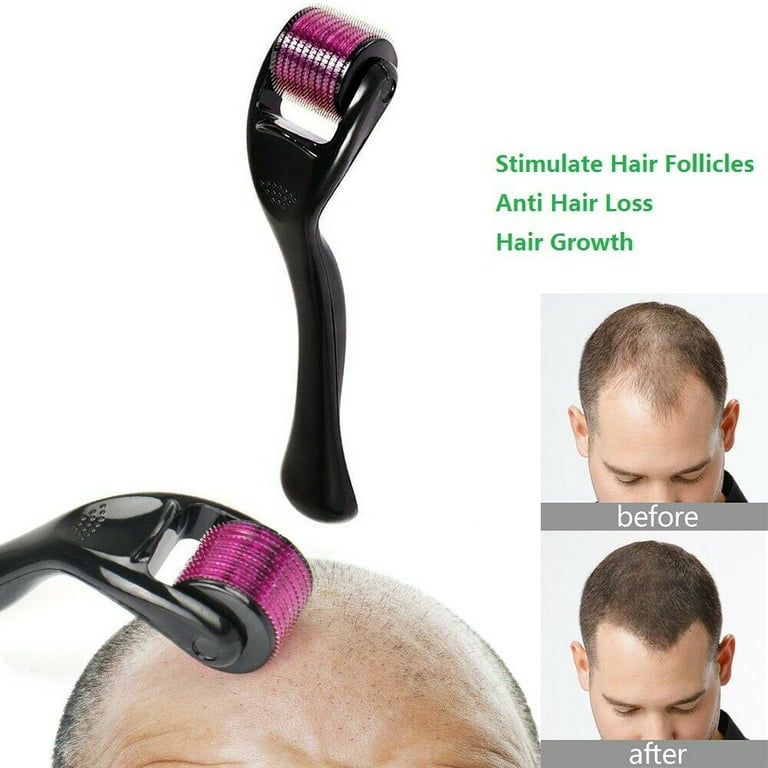 540 Micro Needle Derma Roller for Hair & Skin Therapy