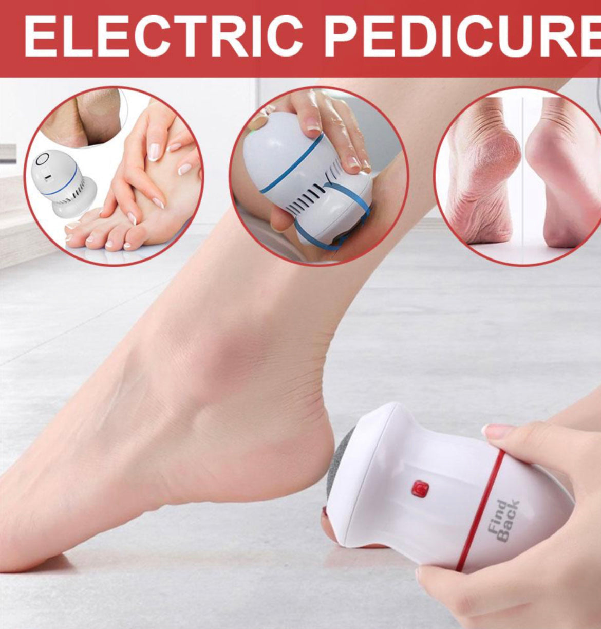 Electric Foot Callus Remover
